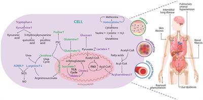 Metabolic fingerprinting of systemic sclerosis: a systematic review